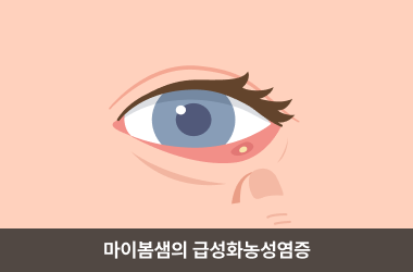 속다래끼